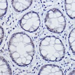 Immunohistochemistry - Anti-USP39 Antibody [ARC2565] (A308362) - Antibodies.com