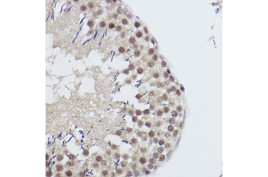 Immunohistochemistry - Anti-USP39 Antibody [ARC2565] (A308362) - Antibodies.com