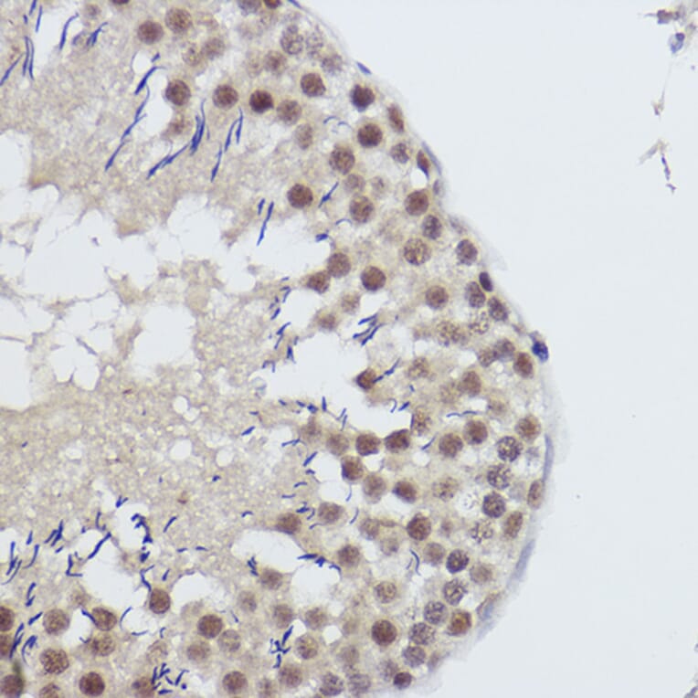 Immunohistochemistry - Anti-USP39 Antibody [ARC2565] (A308362) - Antibodies.com
