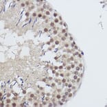 Immunohistochemistry - Anti-USP39 Antibody [ARC2565] (A308362) - Antibodies.com