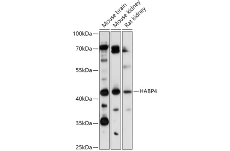 Western Blot - Anti-HABP4 Antibody (A308363) - Antibodies.com