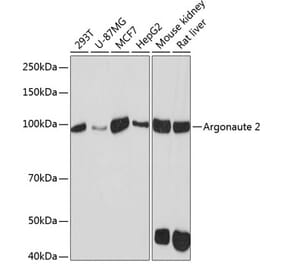 Western Blot - Anti-Argonaute-2 Antibody [ARC0189] (A308366) - Antibodies.com