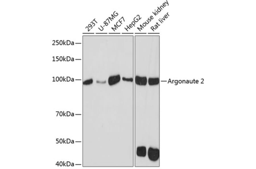 Western Blot - Anti-Argonaute-2 Antibody [ARC0189] (A308366) - Antibodies.com