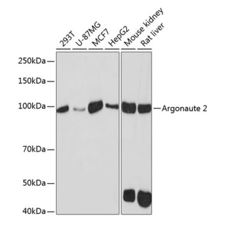 Western Blot - Anti-Argonaute-2 Antibody [ARC0189] (A308366) - Antibodies.com