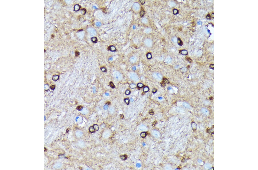 Immunohistochemistry - Anti-Argonaute-2 Antibody [ARC0189] (A308366) - Antibodies.com