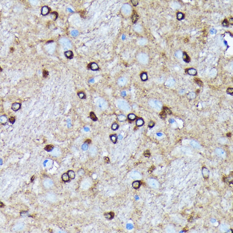 Immunohistochemistry - Anti-Argonaute-2 Antibody [ARC0189] (A308366) - Antibodies.com