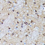 Immunohistochemistry - Anti-Argonaute-2 Antibody [ARC0189] (A308366) - Antibodies.com