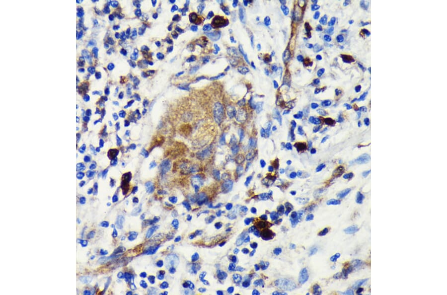 Immunohistochemistry - Anti-Argonaute-2 Antibody [ARC0189] (A308366) - Antibodies.com