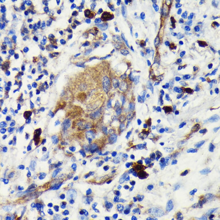 Immunohistochemistry - Anti-Argonaute-2 Antibody [ARC0189] (A308366) - Antibodies.com