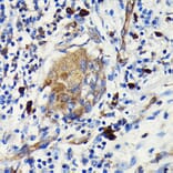 Immunohistochemistry - Anti-Argonaute-2 Antibody [ARC0189] (A308366) - Antibodies.com