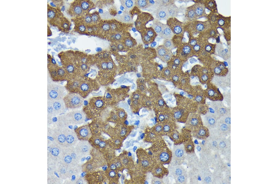 Immunohistochemistry - Anti-Argonaute-2 Antibody [ARC0189] (A308366) - Antibodies.com