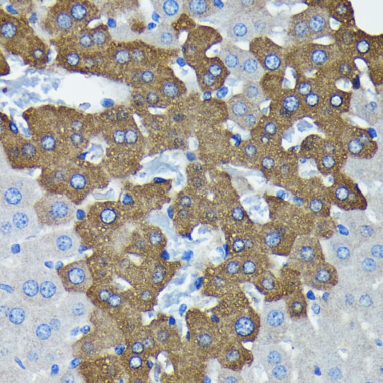 Immunohistochemistry - Anti-Argonaute-2 Antibody [ARC0189] (A308366) - Antibodies.com