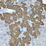 Immunohistochemistry - Anti-Argonaute-2 Antibody [ARC0189] (A308366) - Antibodies.com