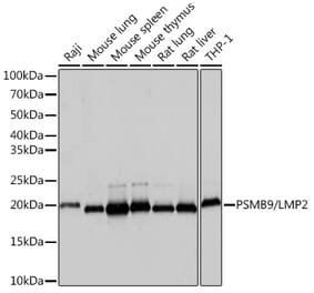 Western Blot - Anti-Proteasome 20S LMP2 Antibody [ARC1629] (A308367) - Antibodies.com