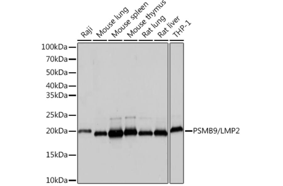 Western Blot - Anti-Proteasome 20S LMP2 Antibody [ARC1629] (A308367) - Antibodies.com