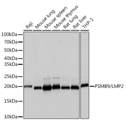 Western Blot - Anti-Proteasome 20S LMP2 Antibody [ARC1629] (A308367) - Antibodies.com