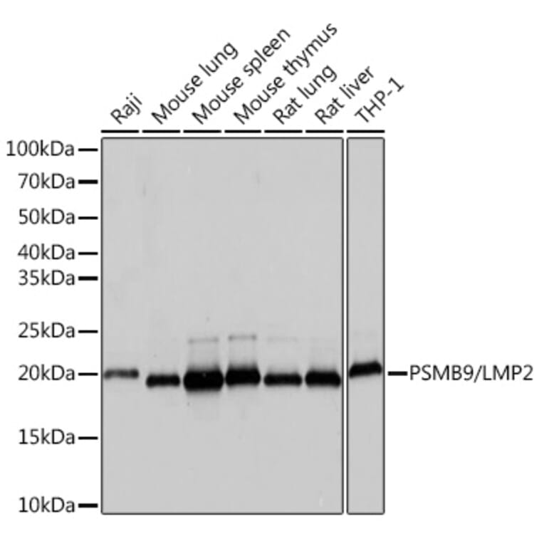 Western Blot - Anti-Proteasome 20S LMP2 Antibody [ARC1629] (A308367) - Antibodies.com