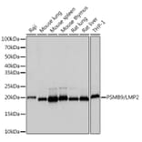 Western Blot - Anti-Proteasome 20S LMP2 Antibody [ARC1629] (A308367) - Antibodies.com