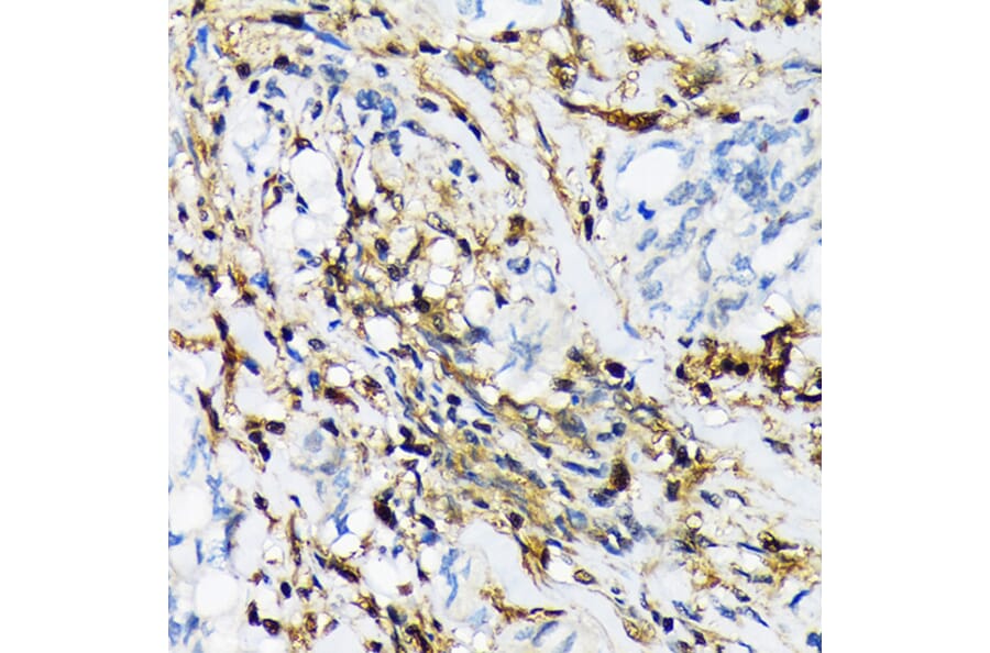 Immunohistochemistry - Anti-Proteasome 20S LMP2 Antibody [ARC1629] (A308367) - Antibodies.com