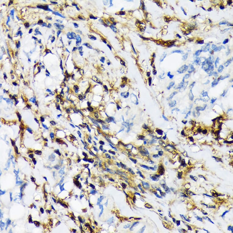 Immunohistochemistry - Anti-Proteasome 20S LMP2 Antibody [ARC1629] (A308367) - Antibodies.com
