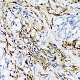 Immunohistochemistry - Anti-Proteasome 20S LMP2 Antibody [ARC1629] (A308367) - Antibodies.com