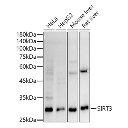 Western Blot - Anti-SIRT3 Antibody [ARC51535] (A308370) - Antibodies.com