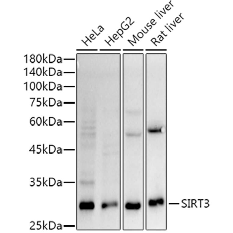 Western Blot - Anti-SIRT3 Antibody [ARC51535] (A308370) - Antibodies.com