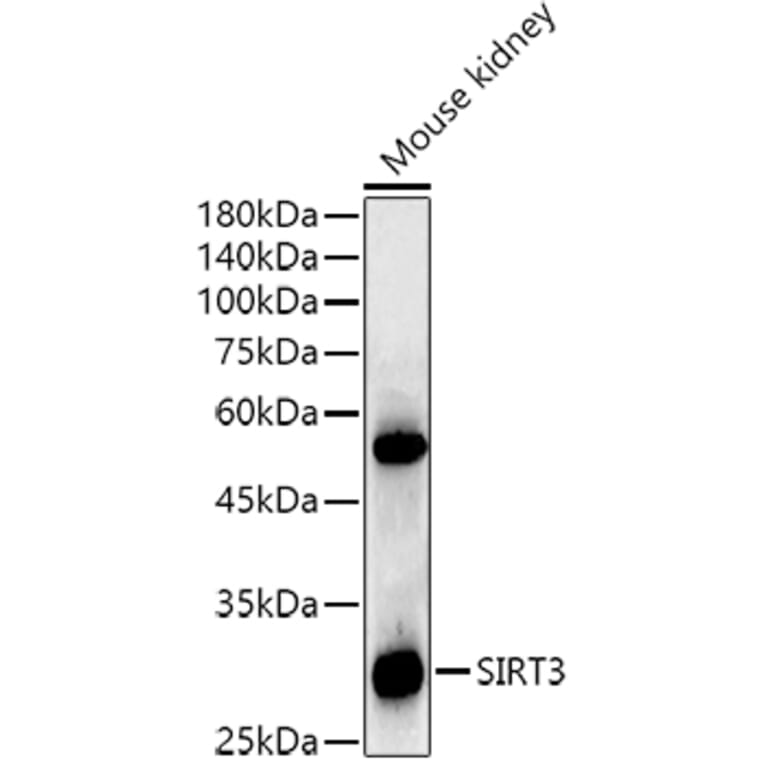 Western Blot - Anti-SIRT3 Antibody [ARC51535] (A308370) - Antibodies.com