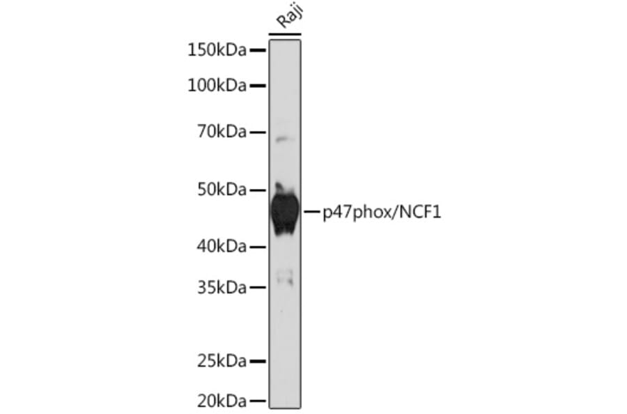 Western Blot - Anti-NCF1/p47-phox Antibody [ARC1206] (A308374) - Antibodies.com