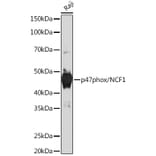 Western Blot - Anti-NCF1/p47-phox Antibody [ARC1206] (A308374) - Antibodies.com