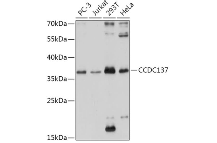 Western Blot - Anti-CC137 Antibody (A308375) - Antibodies.com