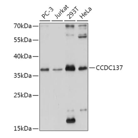 Western Blot - Anti-CC137 Antibody (A308375) - Antibodies.com
