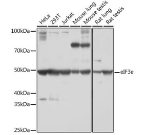 Western Blot - Anti-eIF3e Antibody [ARC1997] (A308376) - Antibodies.com