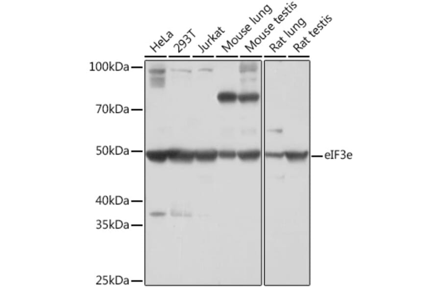 Western Blot - Anti-eIF3e Antibody [ARC1997] (A308376) - Antibodies.com