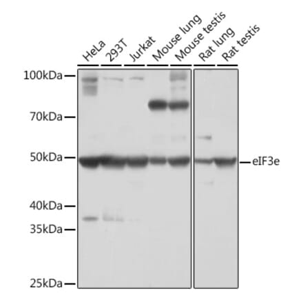 Western Blot - Anti-eIF3e Antibody [ARC1997] (A308376) - Antibodies.com