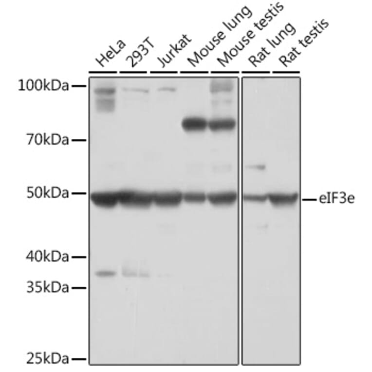 Western Blot - Anti-eIF3e Antibody [ARC1997] (A308376) - Antibodies.com