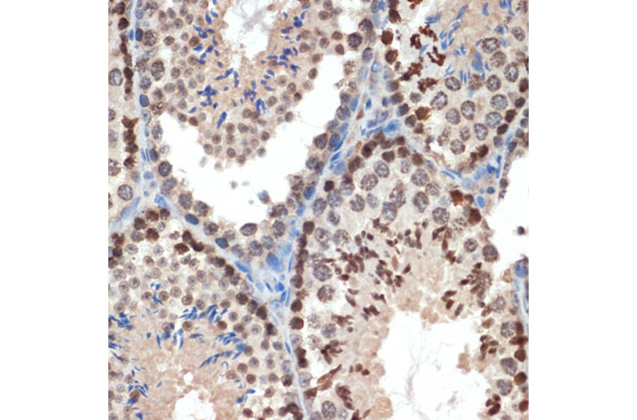 Immunohistochemistry - Anti-eIF3e Antibody [ARC1997] (A308376) - Antibodies.com