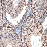 Immunohistochemistry - Anti-eIF3e Antibody [ARC1997] (A308376) - Antibodies.com