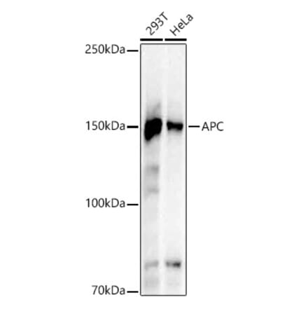 Western Blot - Anti-APC Antibody [ARC53932] (A308377) - Antibodies.com