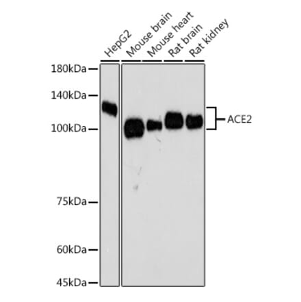 Western Blot - Anti-ACE2 Antibody [ARC50948] (A308382) - Antibodies.com