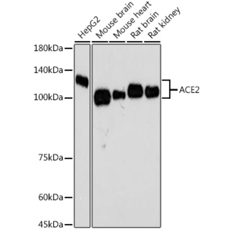Western Blot - Anti-ACE2 Antibody [ARC50948] (A308382) - Antibodies.com