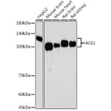 Western Blot - Anti-ACE2 Antibody [ARC50948] (A308382) - Antibodies.com
