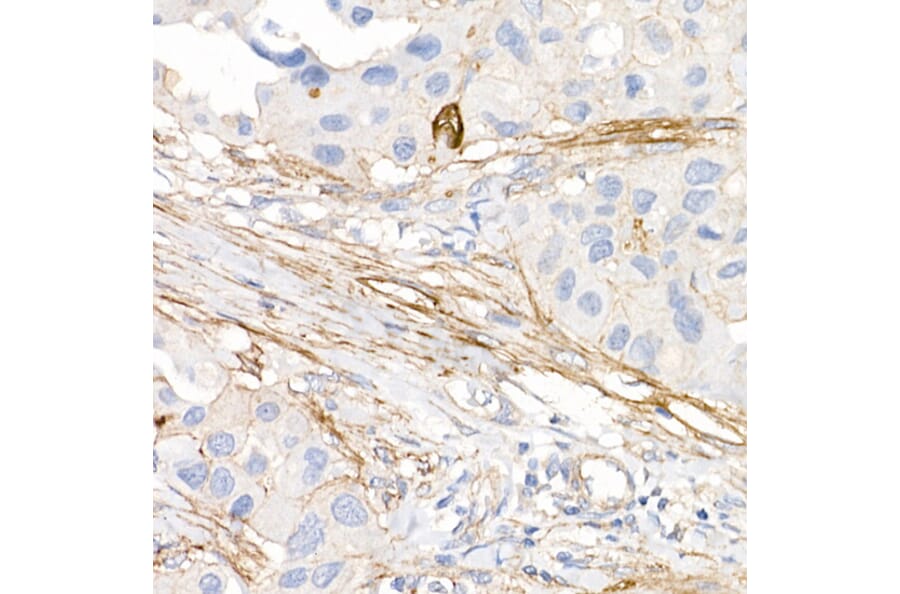 Immunohistochemistry - Anti-ACE2 Antibody [ARC50948] (A308382) - Antibodies.com