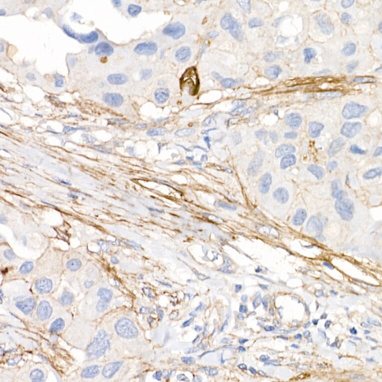 Immunohistochemistry - Anti-ACE2 Antibody [ARC50948] (A308382) - Antibodies.com