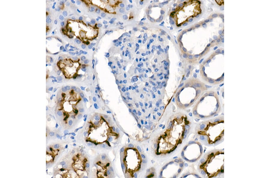 Immunohistochemistry - Anti-ACE2 Antibody [ARC50948] (A308382) - Antibodies.com