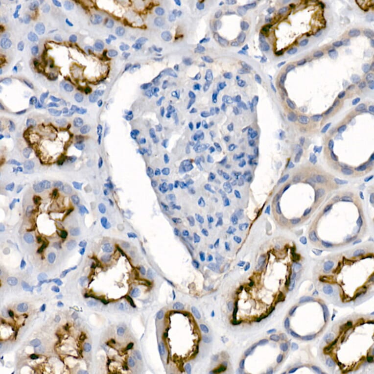 Immunohistochemistry - Anti-ACE2 Antibody [ARC50948] (A308382) - Antibodies.com