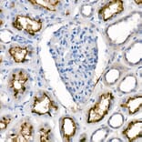 Immunohistochemistry - Anti-ACE2 Antibody [ARC50948] (A308382) - Antibodies.com