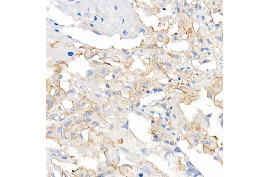 Immunohistochemistry - Anti-ACE2 Antibody [ARC50948] (A308382) - Antibodies.com