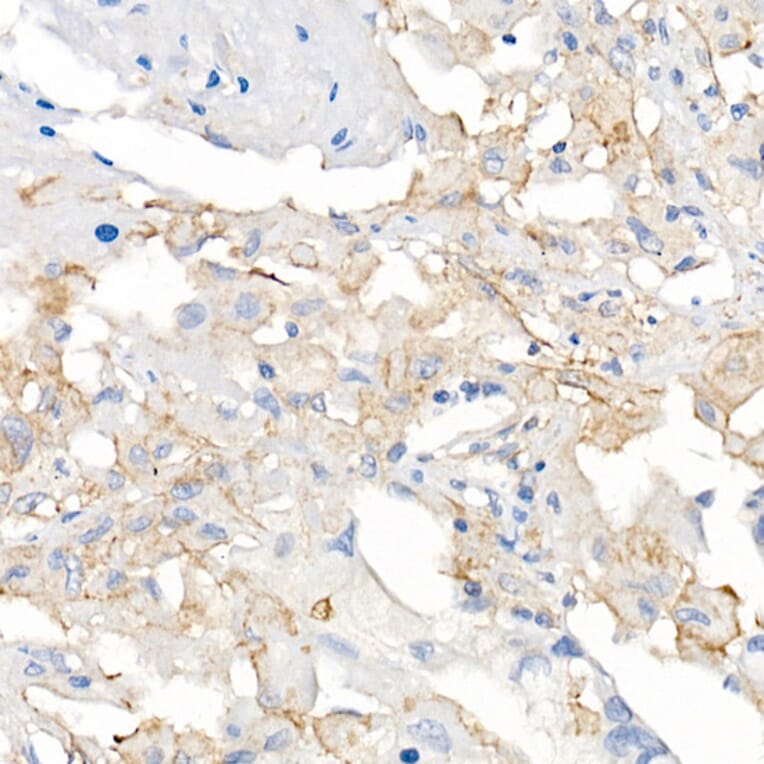 Immunohistochemistry - Anti-ACE2 Antibody [ARC50948] (A308382) - Antibodies.com
