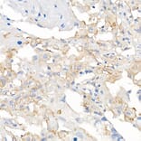 Immunohistochemistry - Anti-ACE2 Antibody [ARC50948] (A308382) - Antibodies.com